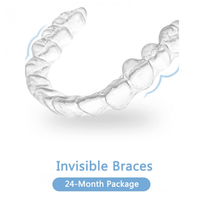 Factory direct supply, online customization, Invisalign, invisible teeth correction braces (treatment duration: 24 months)