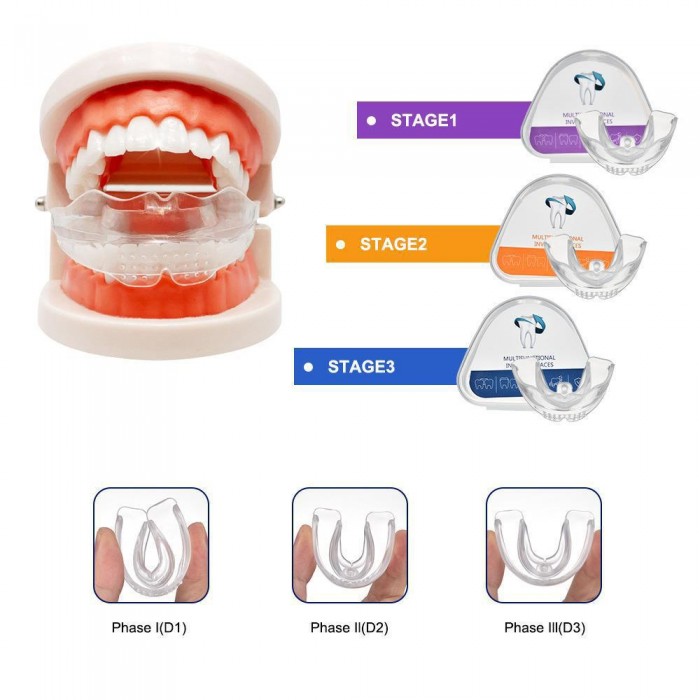 4D Invisible Braces Adult Teeth Retainer Braces Nighttime Anti-Abrasive Braces (Three Stages)