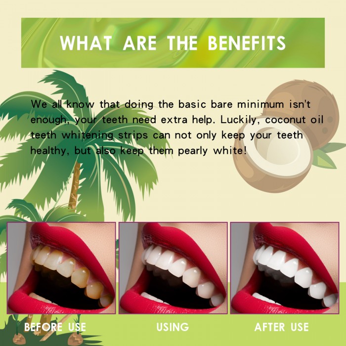 天然植物から抽出されたココナッツオイル ホワイトニング トゥース ストリップ (お徳用 50 個入り) は、歯を素早く白くします。