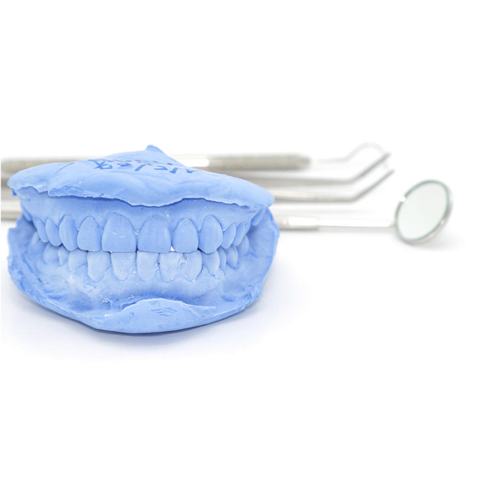 Dental impression kit to make your own dental impressions